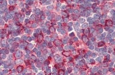 Immunohistochemistry-Paraffin: GPR26 Antibody [NBP3-14355]